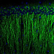 IF of mouse hippocampal neuron projections stained with DSHB antibody PCRP-BCL6-1D3 against BCL6 (green) and DAPI (blue). Image credit: NIH Common Fund Protein Capture Reagents Program and CDI Labs
